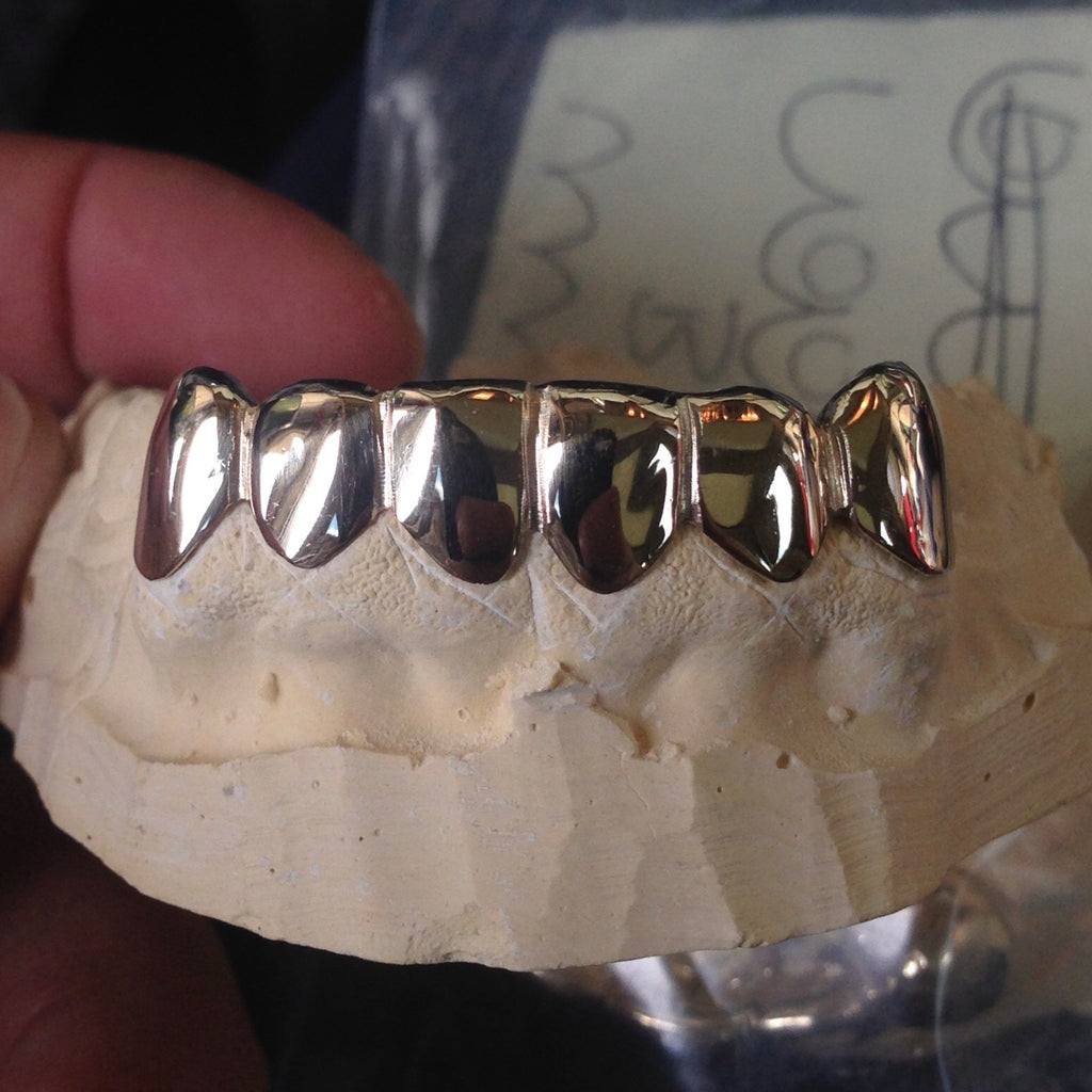 6 Piece 14k Gold Grill
